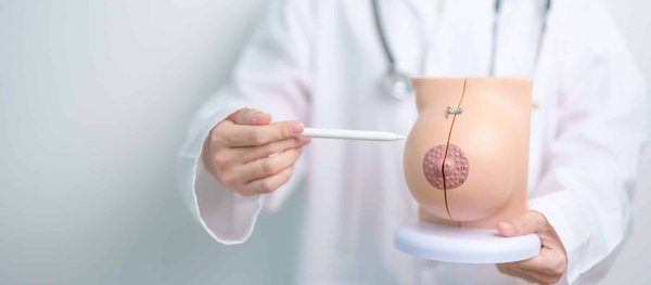 Les différentes étapes de l'augmentation mammaire